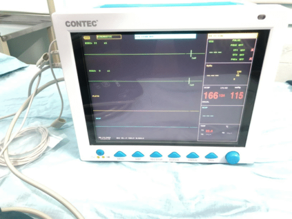 Contec CMS8000 12-Inch Multi-Parameter Patient Monitor – SPO₂, NIBP, ECG, Pulse Rate & Trend Data Display - Image 5